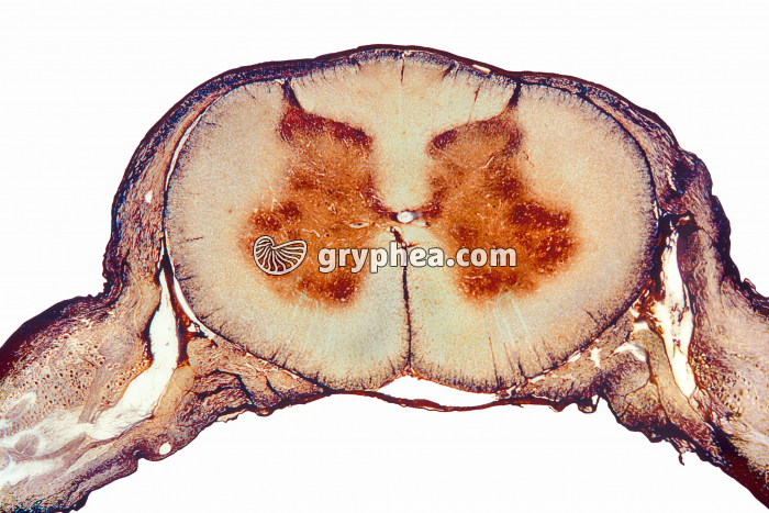 Moelle épinière + ganglions rachidiens CT x 12 - gryphea.org